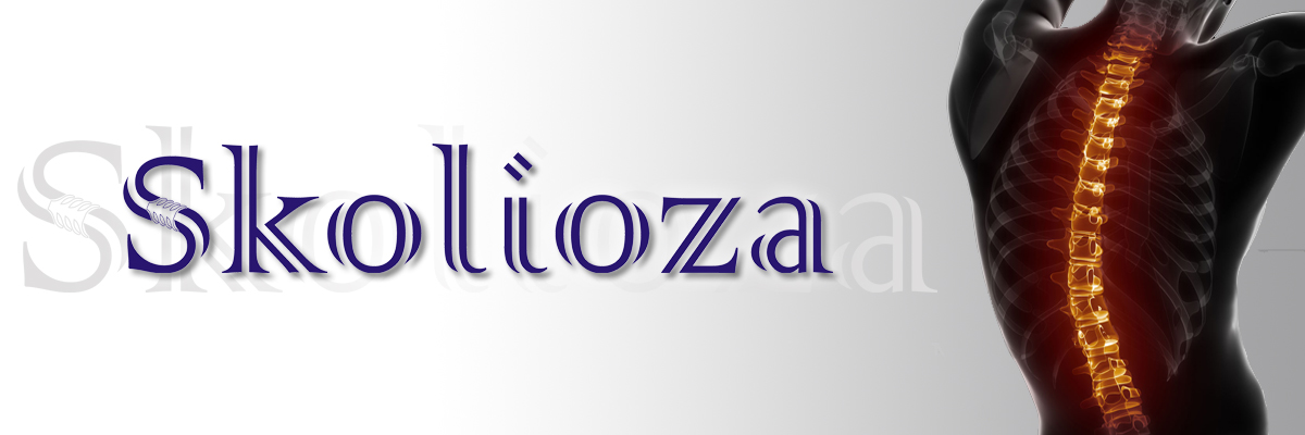 Skolioza..ba